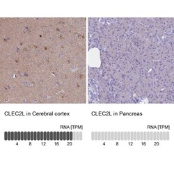 CLEC2L Antibody, Novus Biologicals 25 &mu;L, Unlabeled:Antibodies, Polyclonal